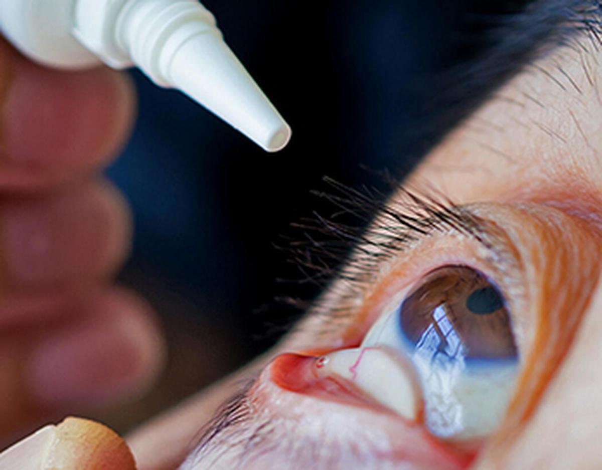 Openbaar Lichaam Bonaire: Terugroepactie oogdruppels van Global Pharma